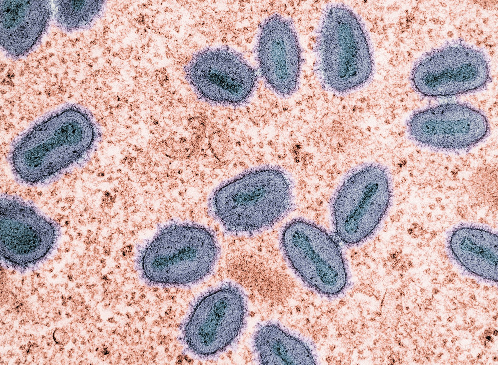 Mpumalanga faces Mpox threat amidst growing concerns