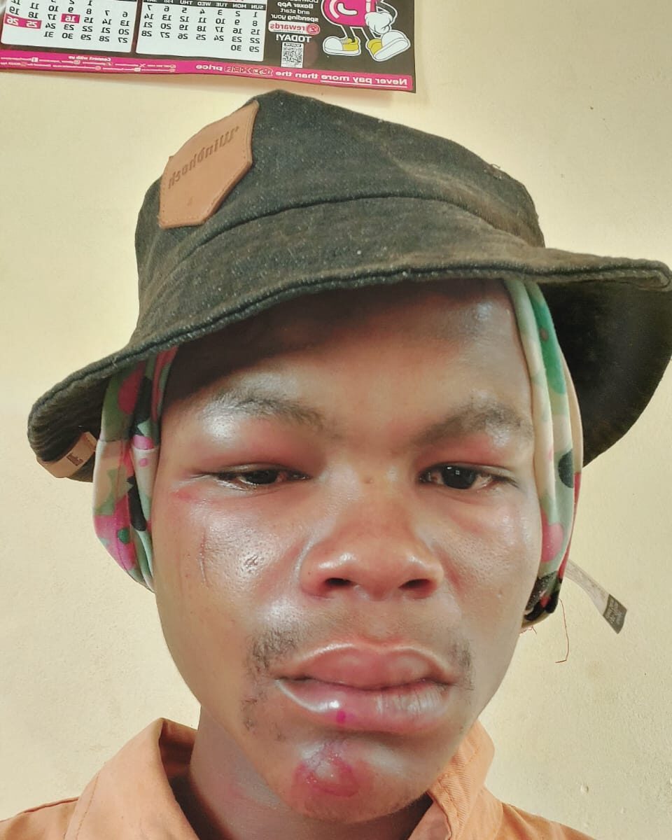 ‘They almost killed me’ – local resident wrongfully accused of theft and beaten